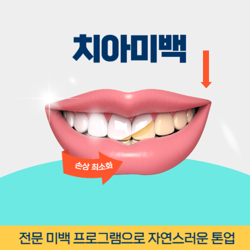 제주치과 제주시 치과 치아미백